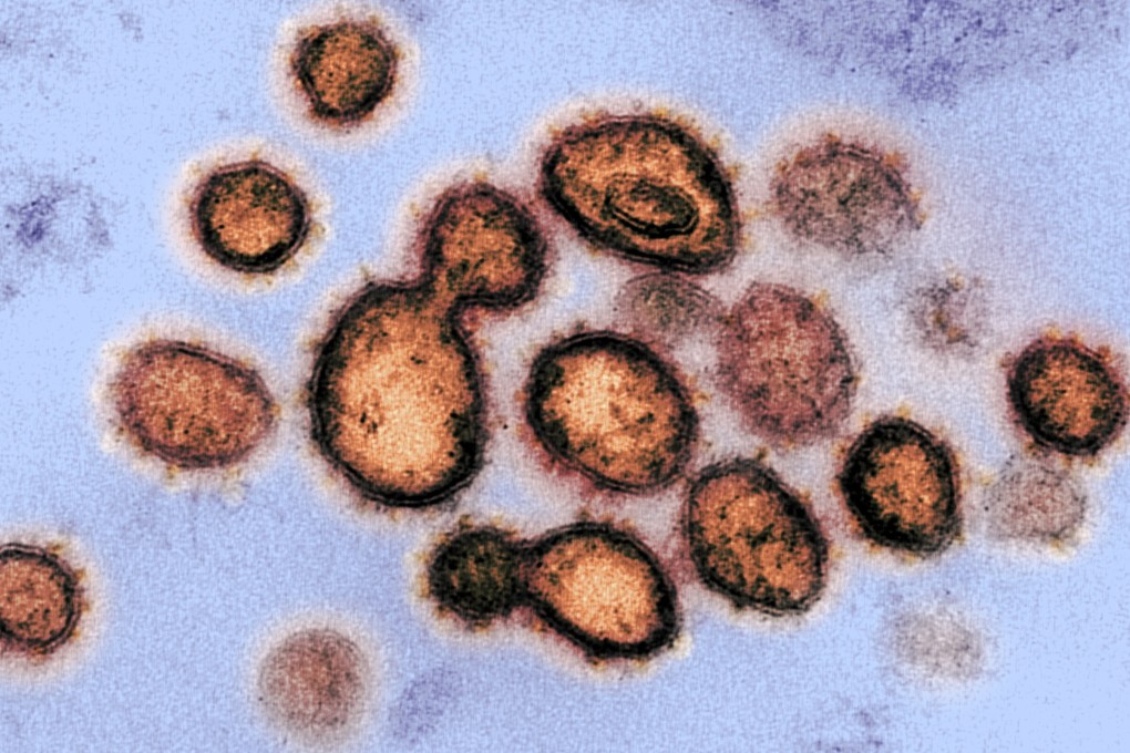 A transmission electron microscope image of Sars-CoV-2, the virus that causes Covid-19. Image: National Institutes of Health via EPA-EFE
