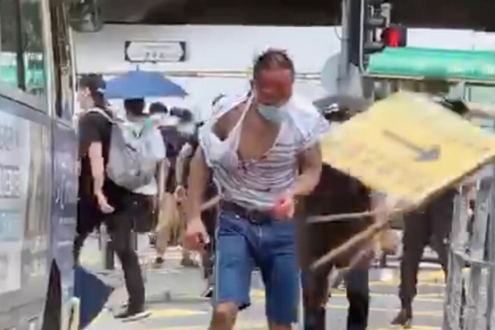 The attack left the lawyer with 20 stitches. Photo: Handout