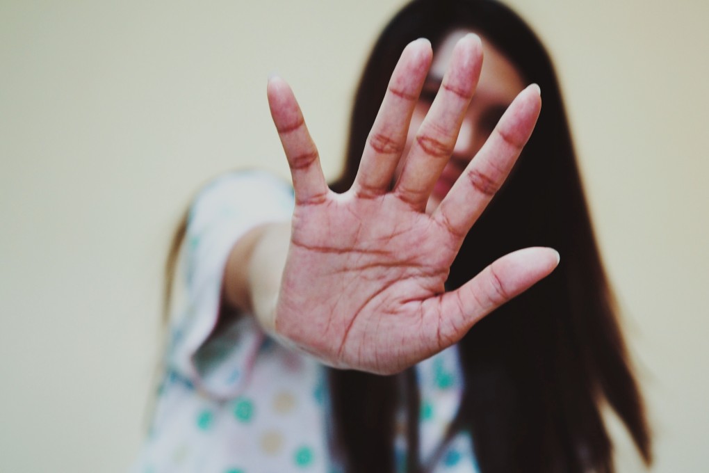 After a court found she had been the victim of sexual harassment, 29-year-old Xiao says the court process has been long and difficult with a high emotional and personal cost. Photo: Shutterstock