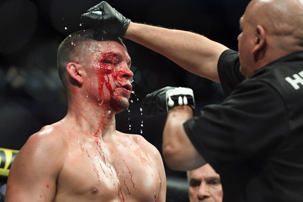 UFC welterweight Nate Diaz gets treatment from a doctor in his fight against Jorge Masvidal at UFC 244 in Madison Square Garden, New York in November of 2019. Photo: USA Today