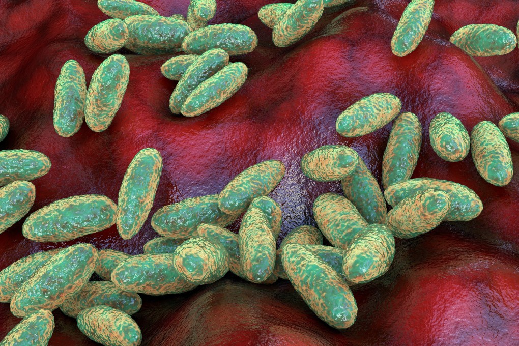 Plague bacteria Yersinia pestis. Illustration: Shutterstock Images