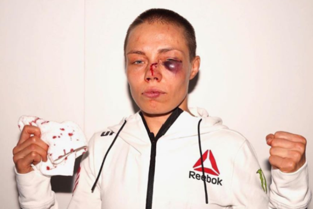 Former UFC strawweight champion Rose Namajunas poses after her fight with Jessica Andrade at UFC 251 at Fight Island, Abu Dhabi in July. Photo: Instagram / Rose Namajunas