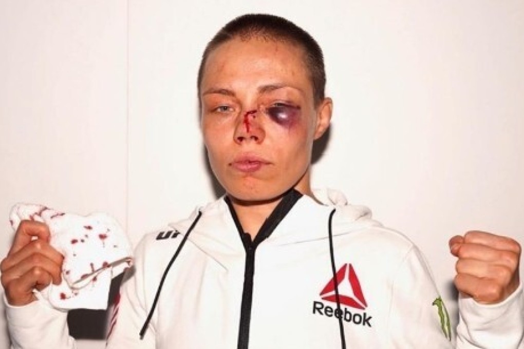 Former UFC strawweight champion Rose Namajunas after her fight with Jessica Andrade at UFC 251 on Fight Island, Abu Dhabi. Photo: Instagram/Rose Namajunas