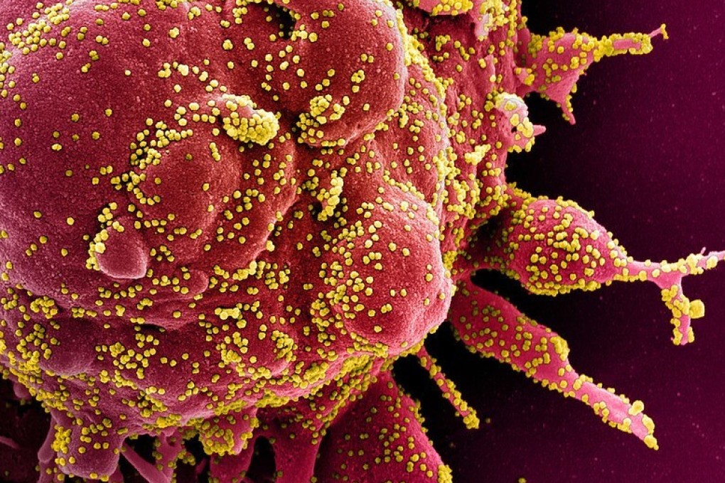 The human body produces T cells to fight invaders like the coronavirus. Yellow coronavirus particles can be seen emerging from a red human cell in this colourised electron micrograph image. Photo: National Institute of Allergy and Infectious Diseases handout via AFP