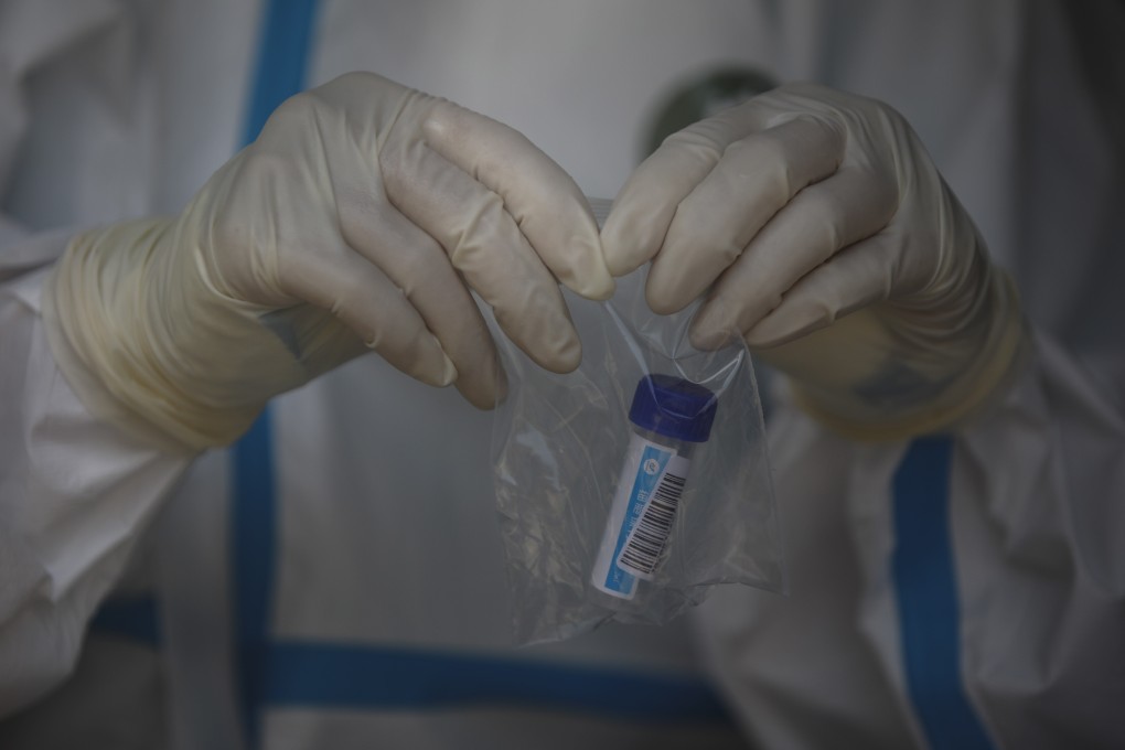 Testing for Covid-19 at Beijing Puren Hospital in Beijing on July 14. Photo: EPA-EFE