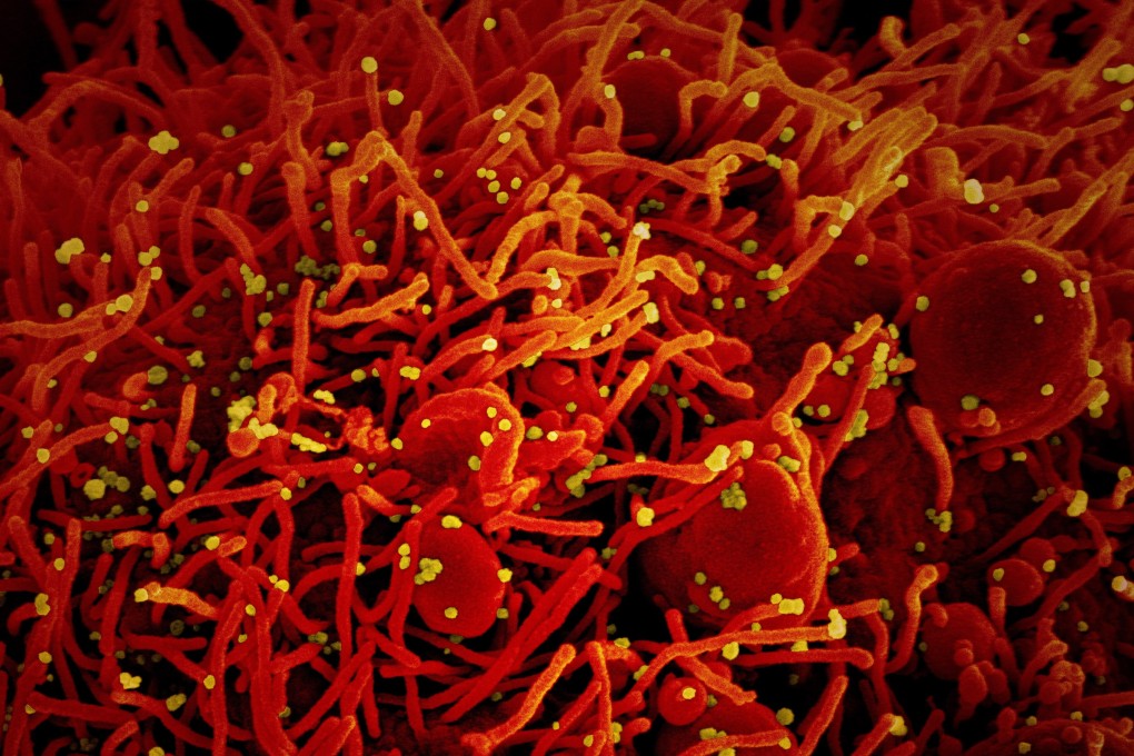 The coronavirus has infected more than 13.8 million people around the world. Photo: US National Institutes of Health via EPA-EFE