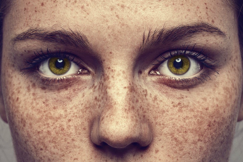 Eating whole foods, not smoking and applying sunscreen can help you achieve healthier skin and slow the appearance of wrinkles. Photo: Shutterstock