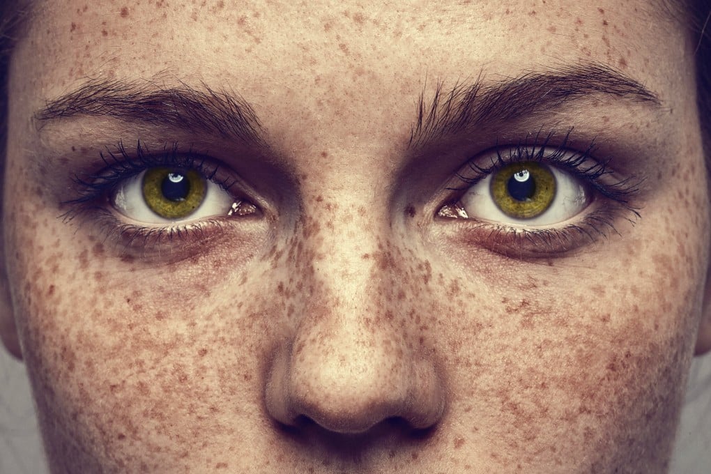 Eating whole foods, not smoking and applying sunscreen can help you achieve healthier skin and slow the appearance of wrinkles. Photo: Shutterstock