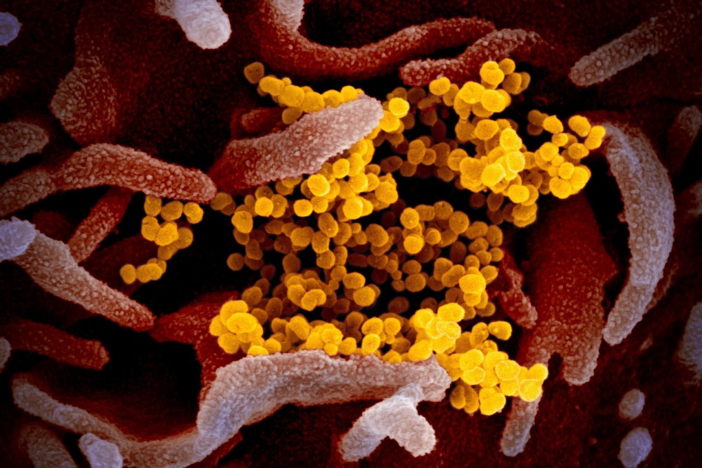 An electron microscope image shows the new coronavirus in yellow, emerging from the surface of cells. The virus is believed to have passed into humans from bats, possibly through an intermediary animal. Photo: EPA-EFE