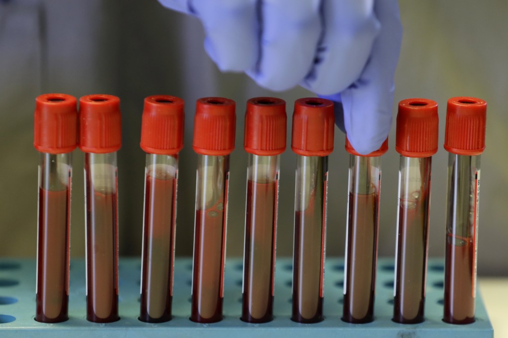 Researchers from Hong Kong and Macau have developed a vaccine that stops a key part of the infection process by preventing the coronavirus from attaching itself to human cells. Photo: AP