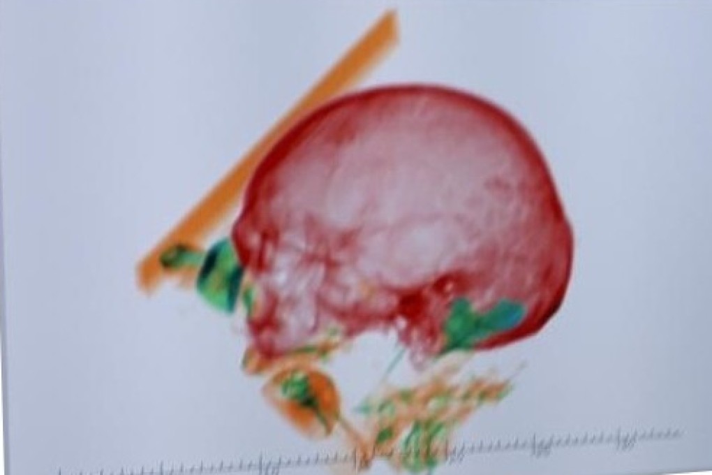 An X-ray of a wooden box containing the bones of a man found in the luggage of a 74-year-old woman at Munich International Airport. Photo: Bundespolizei/DPA