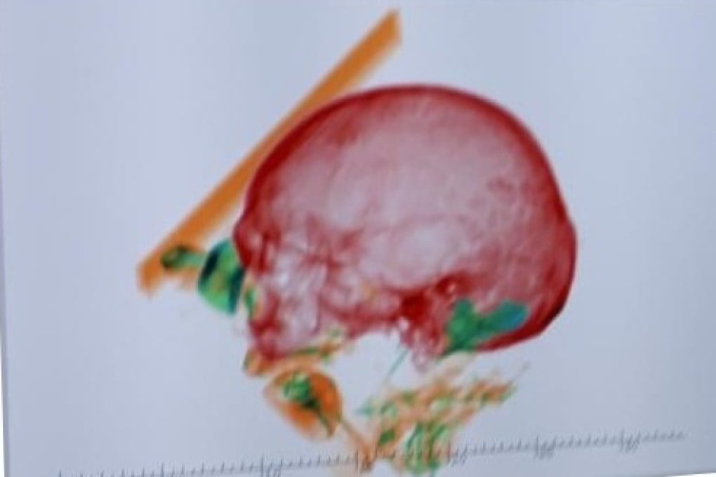 An X-ray of a wooden box containing the bones of a man found in the luggage of a 74-year-old woman at Munich International Airport. Photo: Bundespolizei/DPA
