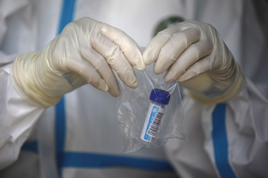 Studies suggest previous exposure to common cold coronaviruses could help people fight Covid-19. Photo: EPA-EFE