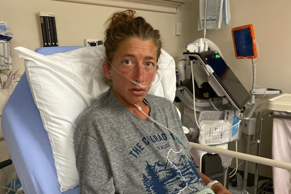 Courtney Dauwalter in hospital after her Colorado Trail FKT attempt. Photo: @courtneydauwalter/Instagram