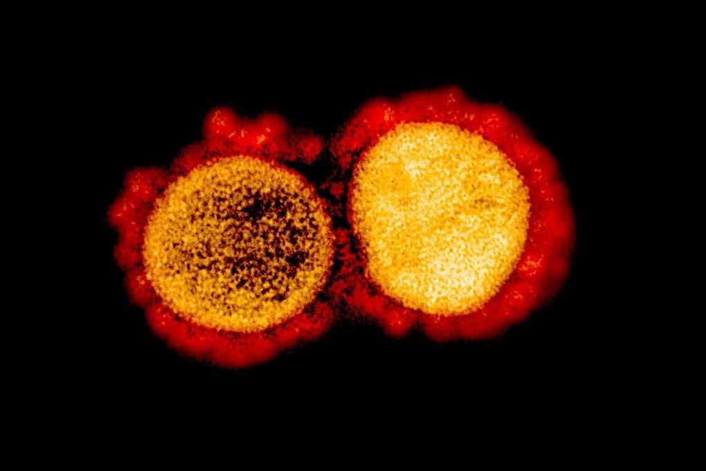 The China Metallurgical Group Corporation warned PNG authorities that 48 staff who returned from China this month may test positive for the virus because they had received a vaccine. This image courtesy of the National Institute of Allergy and Infectious Diseases, shows a transmission electron micrograph of Sars-CoV-2 virus particles, isolated from a patient. Photo: AFP