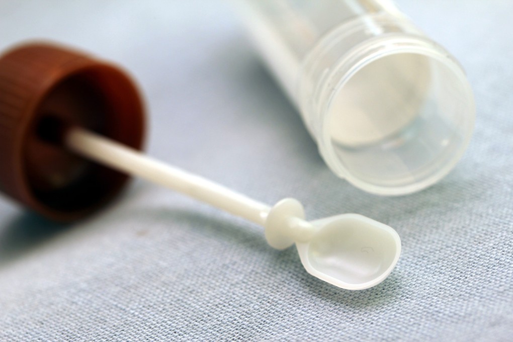 A Chinese University study found samples of the coronavirus in patients’ stool, sometimes days after they had already tested negative. Photo: Shutterstock