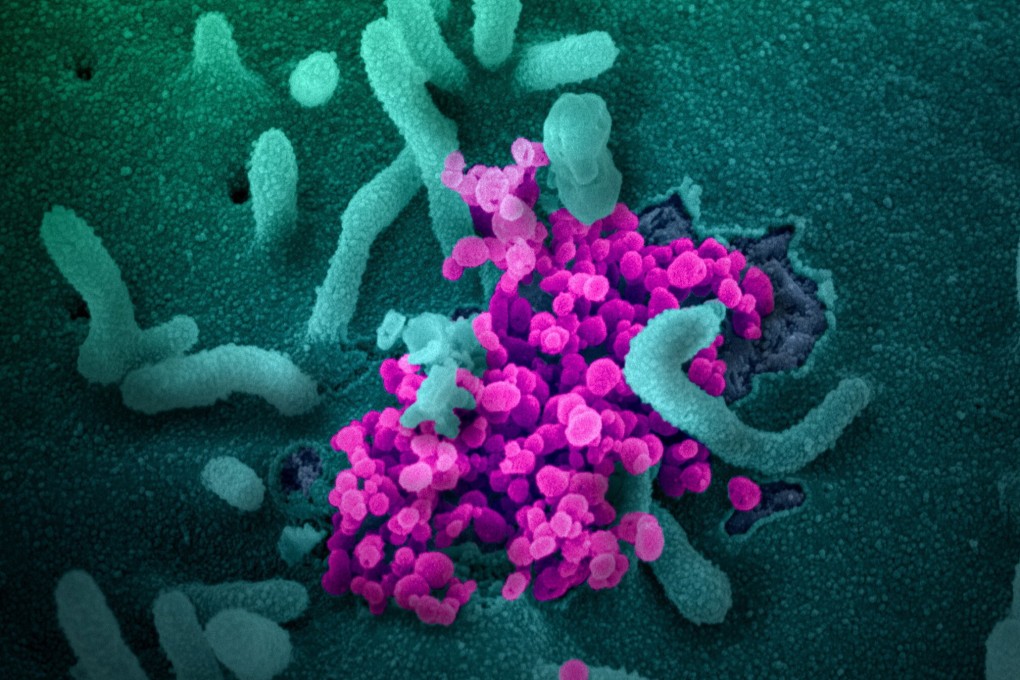 Less than 1 per cent of people surveyed said they were completely symptom-free. Photo: EPA-EFE