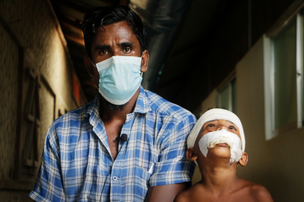 Abu Siddik, a Rohingya refugee in Cox’s Bazar, with his son, who is recovering from some wounds. Photo: MSF