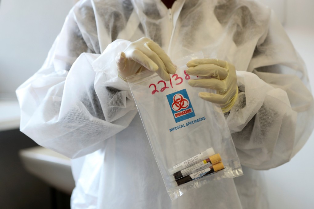 A health worker holds a sample collected from a Covid-19 vaccine trial volunteer in Johannesburg, South Africa in August. Photo: Reuters