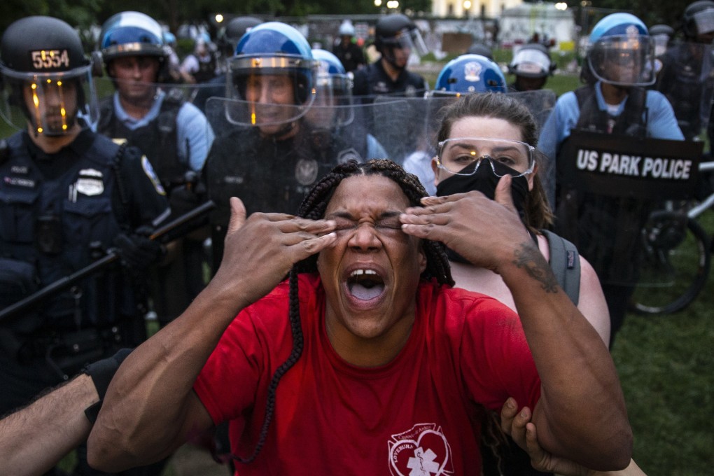 A woman reacts after being hit with pepper spray during a police crackdown in Lafayette Square near the White House in June. Photo: AFP