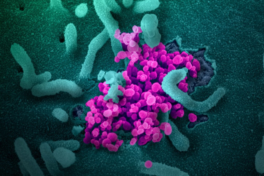 A scanning electron microscope image shows the new coronavirus (round magenta objects) emerging from the surface of cells cultured in the lab. Image: National Institutes of Health via EPA-EFE