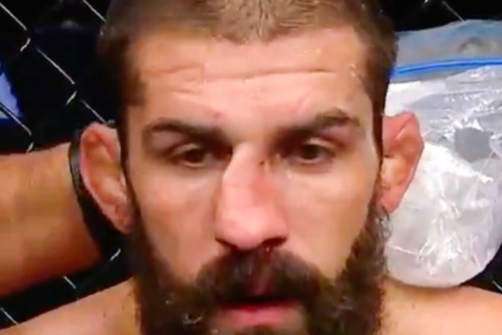 UFC veteran Court McGee’s nose is out of shape during his fight against Carlos Condit at UFC Fight Night in Dubai. Photo: Twitter/Court McGee
