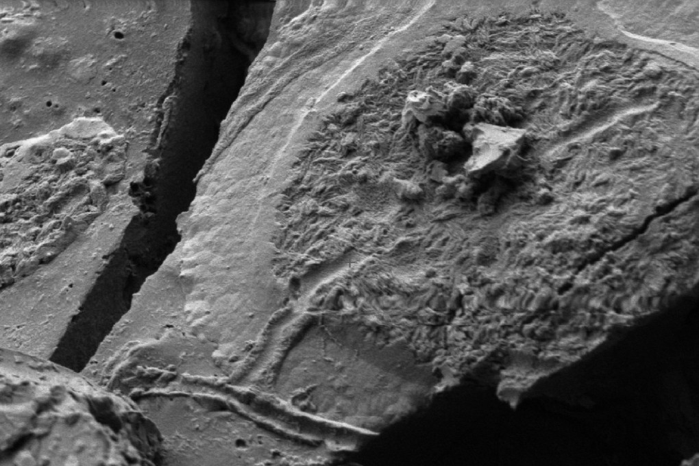 A scanning electron microscope (SEM) image of brain cells of the young man who died almost 2,000 years ago in the eruption of Mount Vesuvius. Photo: AFP