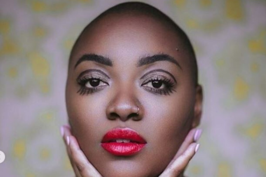 When Instagram removed Nyome Nicholas-Williams’ topless photos, a campaign led to the social media platform changing its rules on nudity.