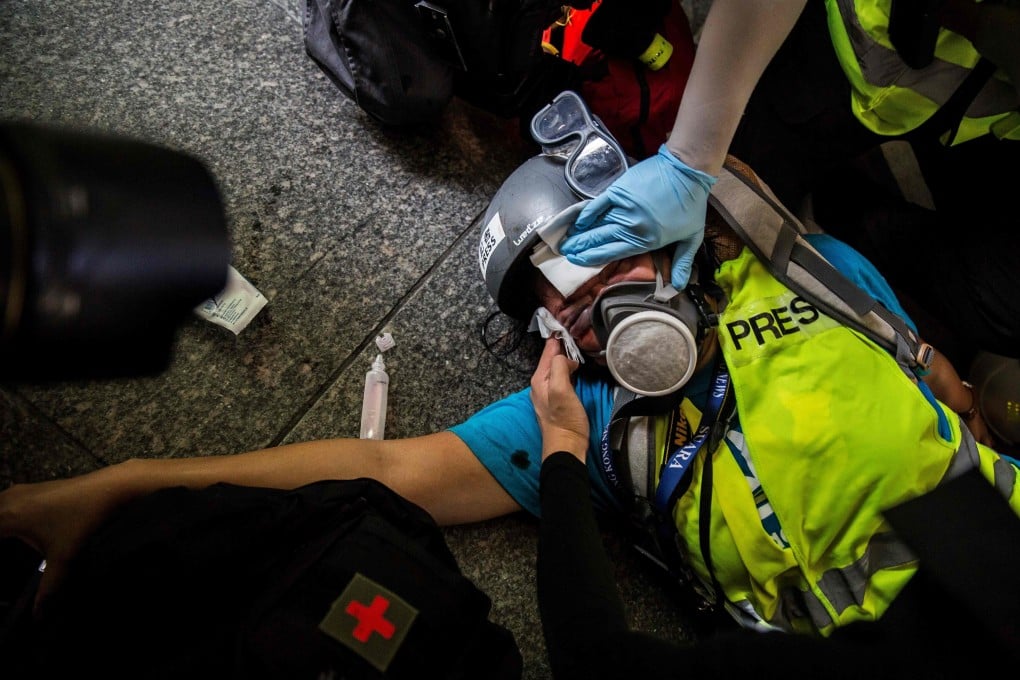 A member of the media receives medical help after being hit in the face with a projectile fired by police during clashes with protesters in Hong Kong on September 29 last year. The global environment for media has worsened. Photo: AFP