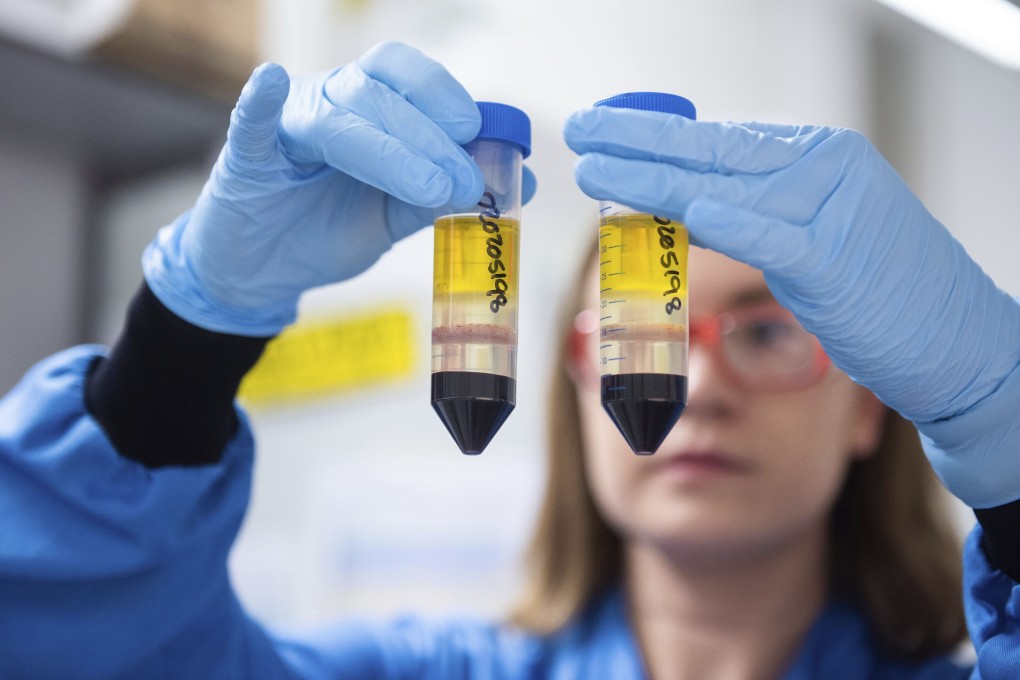 A researcher at the Jenner Institute in Oxford, England, works on the coronavirus vaccine developed by AstraZeneca and Oxford University. Photo: University of Oxford via AP