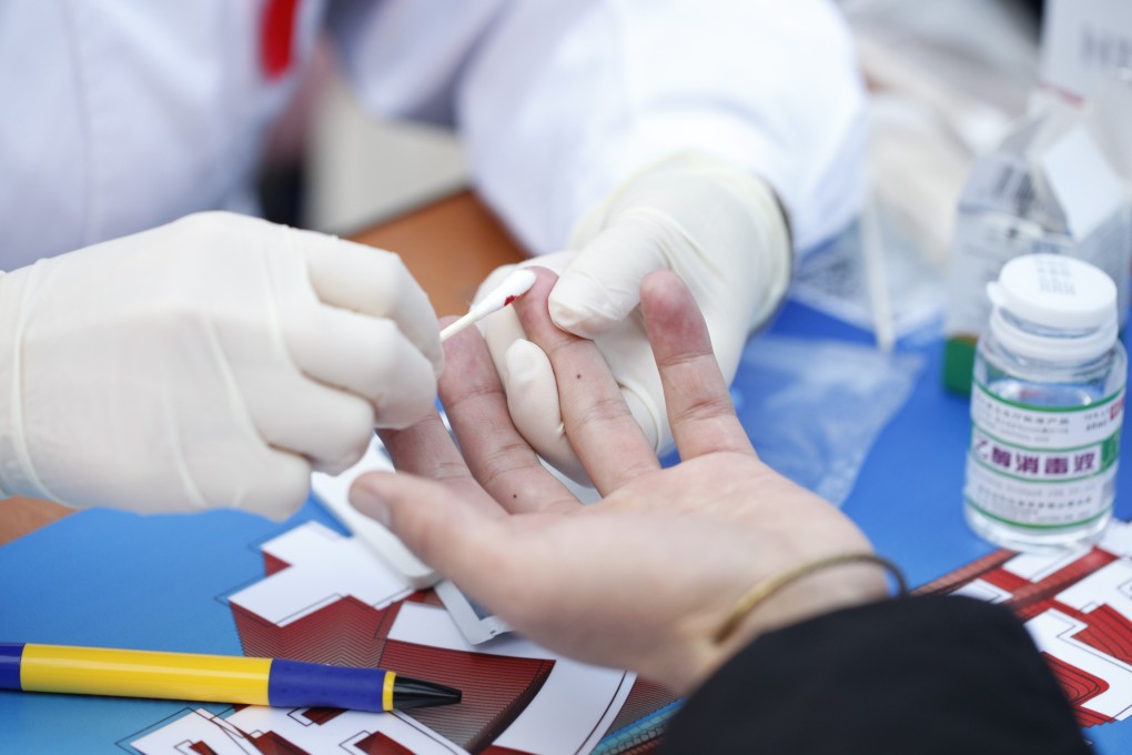 The rising incidence of HIV in China over the past decade runs counter to the global trend of a decline in new cases of the virus. Photo: Huang Haojie