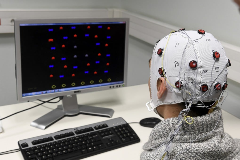 A researcher at CNRS in Grenoble demonstrates a brain-computer interface helmet in this file photo from 2017. In the same year, Shanghai’s Ruijing Hospital used electrode implantation therapy to treat a 45-year-old man with depression. Photo: AFP