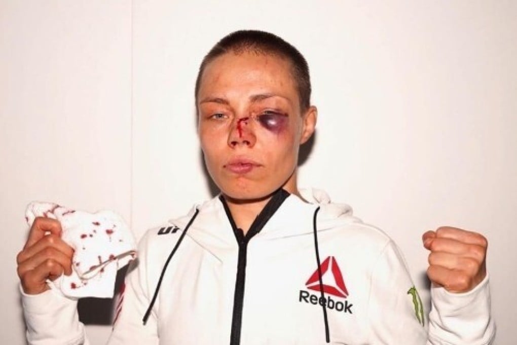 Former UFC strawweight champion Rose Namajunas after her fight with Jessica Andrade at UFC 251 at Fight Island, Abu Dhabi in July. Photo: Instagram/Rose Namajunas