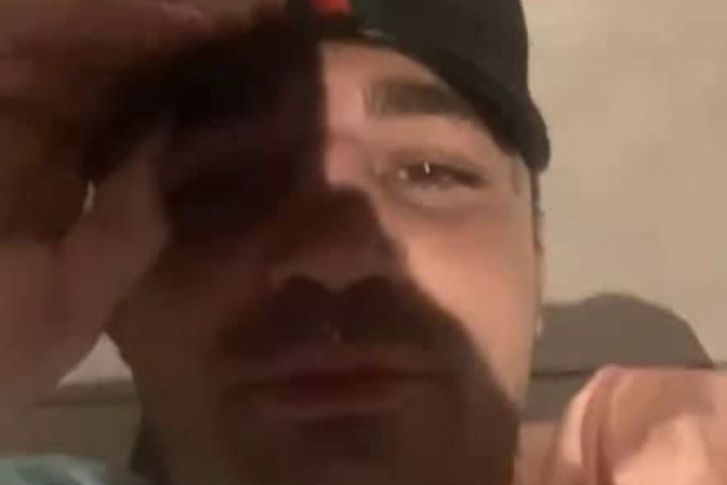 Mike Perry records a video on Instagram while his leg lies in a pool of blood on the floor. Photos: Instagram/Mike Perry