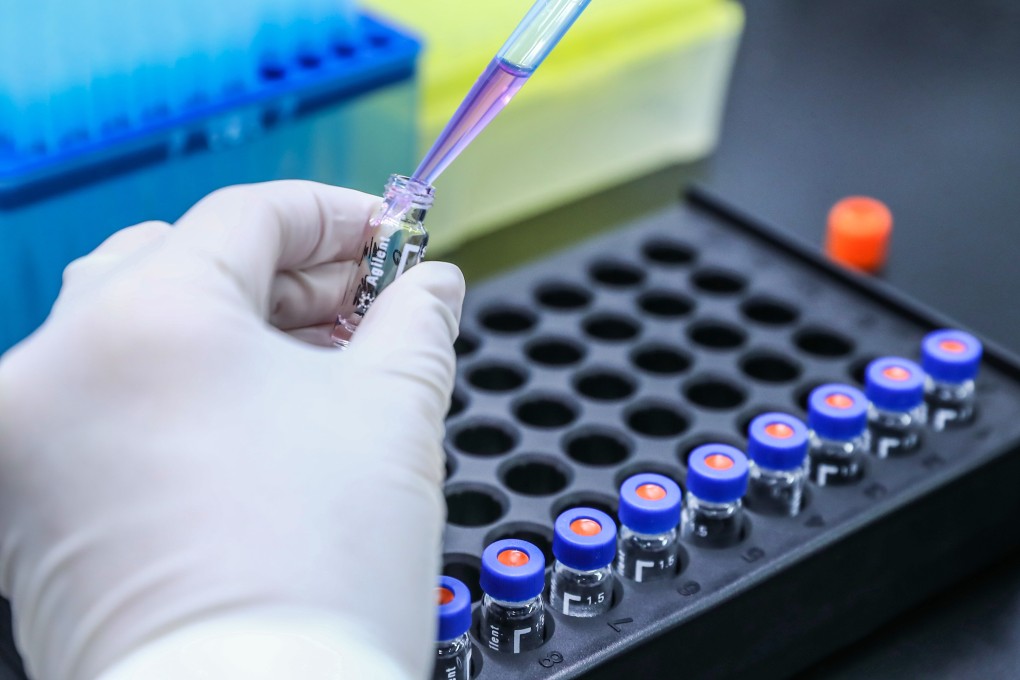 CNBG officials thought inactivated vaccines held the best prospects because the technology was mature and quality controllable. Photo: Xinhua