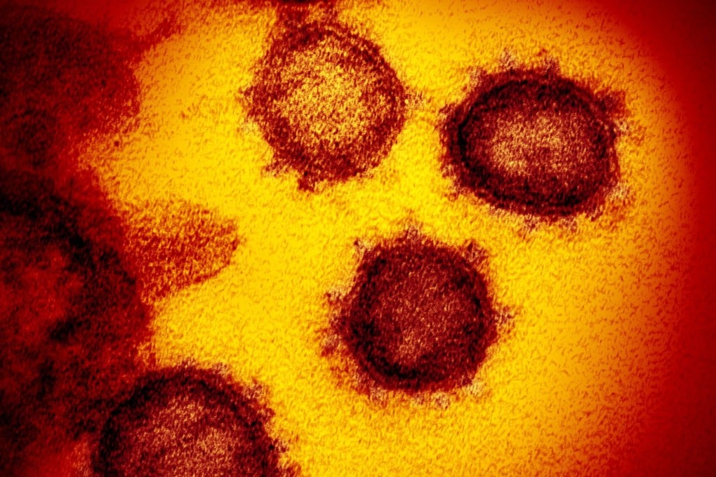 Researchers say they have uncovered what could be Italy’s first case of Covid-19. Photo: EPA-EFE