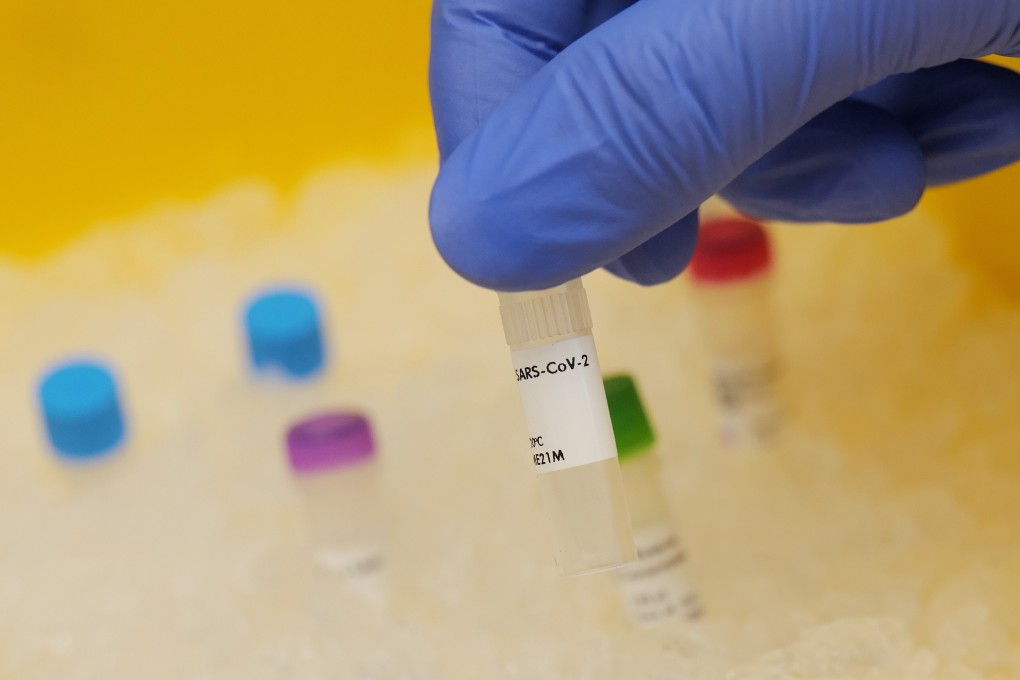 Positive coronavirus samples are ready to be prepared in an ice bucket to get sequenced and analysed for the mutant versions of the coronavirus at the Bioscientia laboratories in Ingelheim, Germany on Wednesday. Photo: Reuters