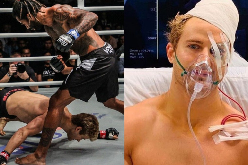 Sage Northcutt is knocked out by Cosmo Alexandre, which required him to undergo nine hours of surgery on eight facial fractures. Photo: ONE Championship/Instagram