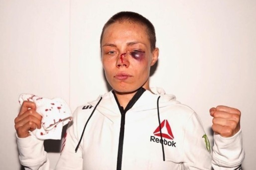 Former UFC strawweight champion Rose Namajunas poses after her fight with Jessica Andrade at UFC 251 on Fight Island, Abu Dhabi in July. Photo: Instagram/Rose Namajunas
