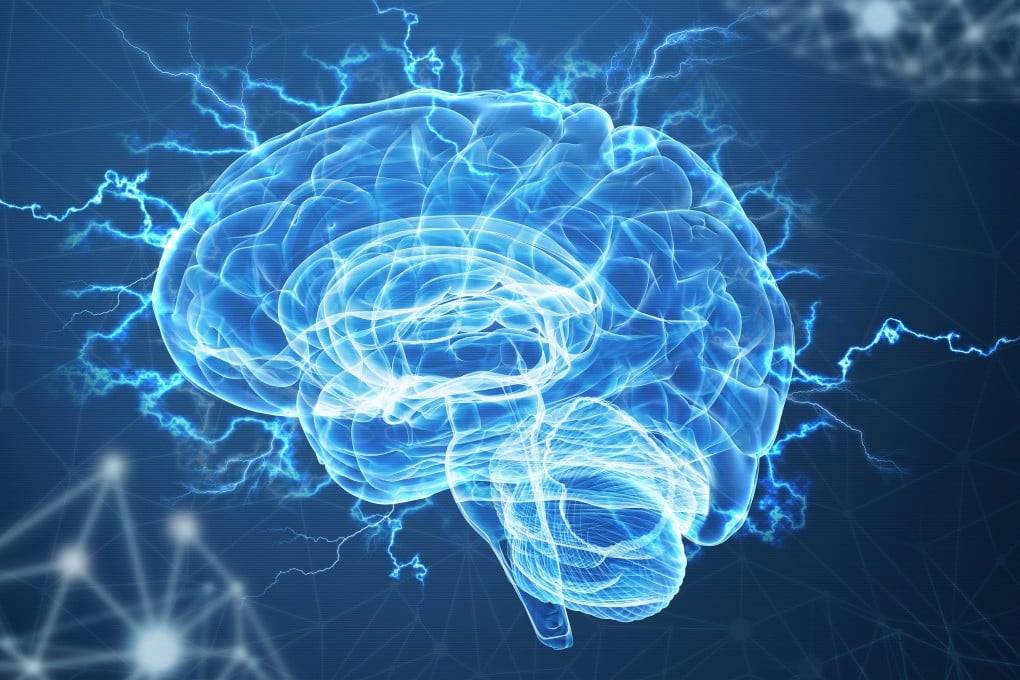 Lawmakers in Chile want to pass legislation that protects a person’s “neuro-rights” from technology that could make you believe things have happened in your life that actually haven’t. Photo: Shutterstock