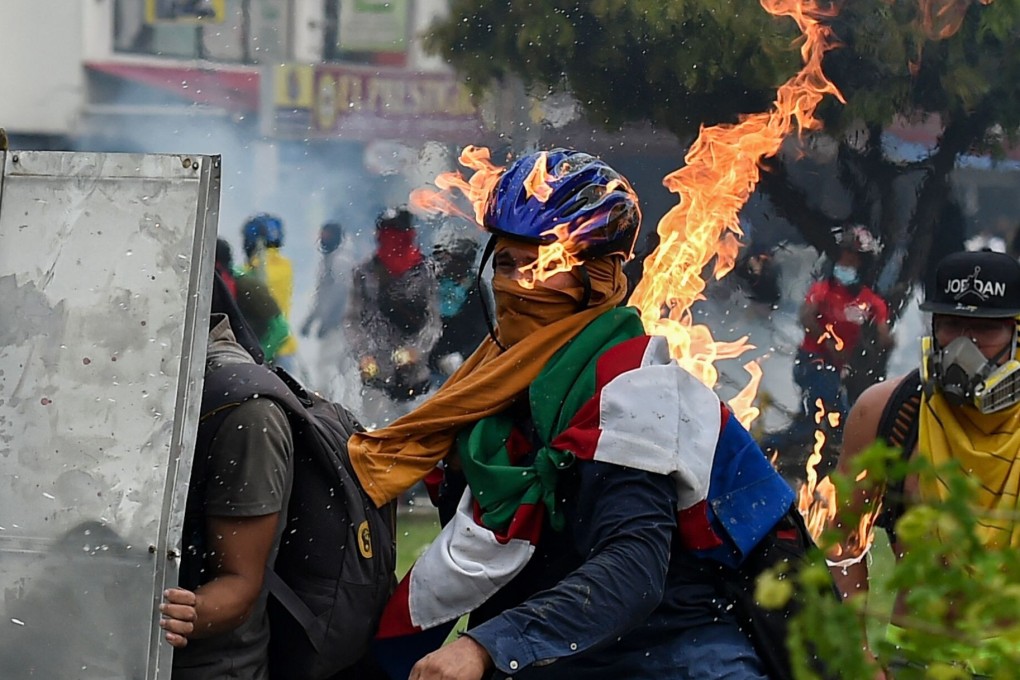 A demonstrator who was hit by a petrol bomb during clashes with riot police in Cali, Colombia. Photo: AFP