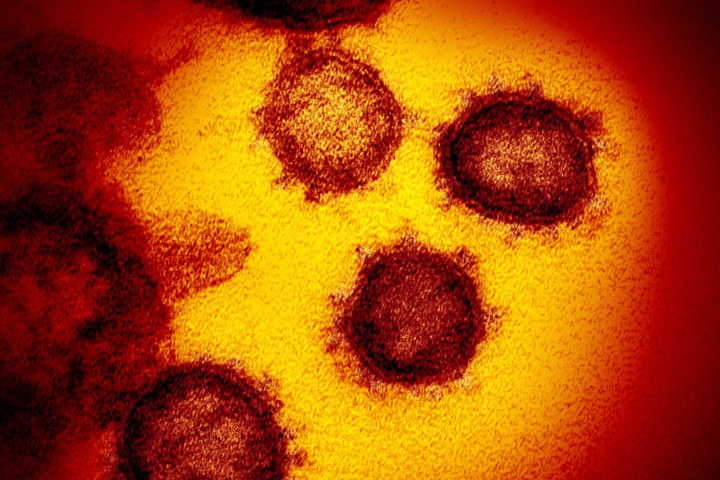 Despite studies suggesting vaccines could be less effective against some variants, virologist Siddharth Sridhar says they are not totally ineffective. Photo: EPA-EFE