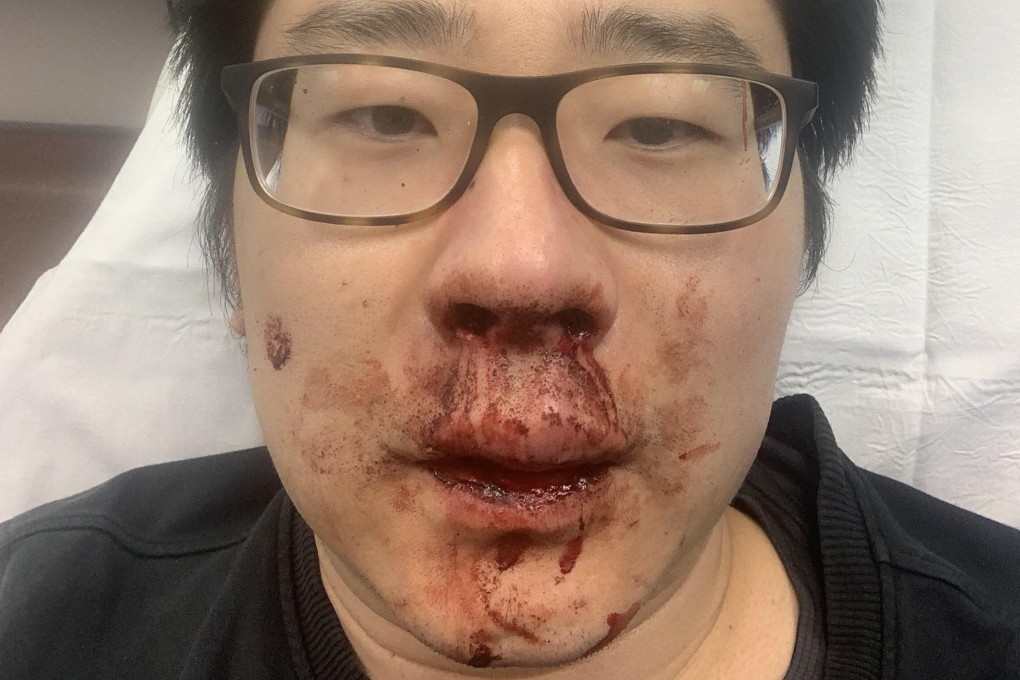 Lecturer Peng Wang was left with a bloody nose and bruises to his face and arm after he was attacked in Southampton in February. File photo: Peng Wang