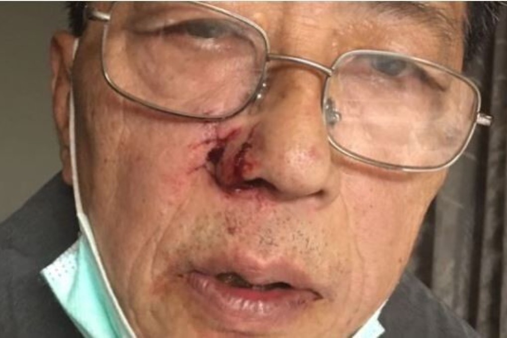 Lyft driver Paul Liao was struck in the face. Photo: GoFundMe