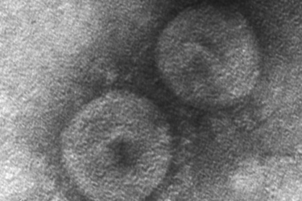 An electron microscope image of CCov-HuPn-2018, the new canine coronavirus that could infect humans found in a pneumonia patient in Sarawak, Malaysia, in 2018. Image: Molecular & Cellular Imaging Centre of the Ohio Agricultural Research and Development Centre, Ohio State University