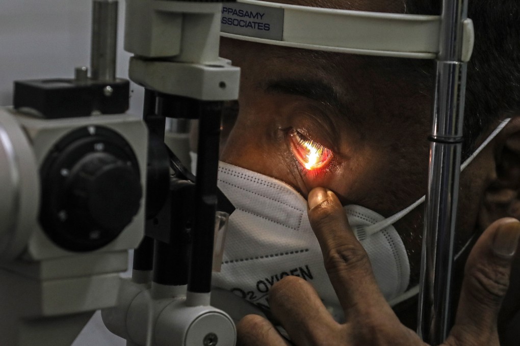 A suspected mucormycosis patient is examined at a hospital in Navi Mumbai, India, on May 25. Mucormycosis, also known as black fungus, appears to be spreading among Covid-19 patients in India. Photo: EPA-EFE