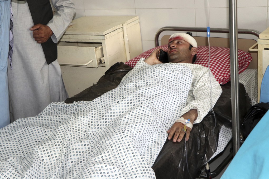 An Afghan man is treated at a hospital after a roadside bomb struck a minivan full of university lecturers and students in Kapisa province northern of Kabul, Afghanistan on Saturday. Photo: AP