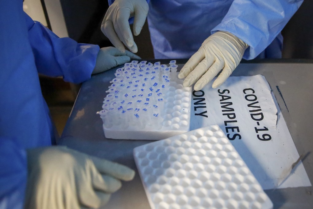 Scientists only spotted the woman’s case because she was enrolled in a study on people with HIV looking at their immune response to Covid-19. File photo: AP