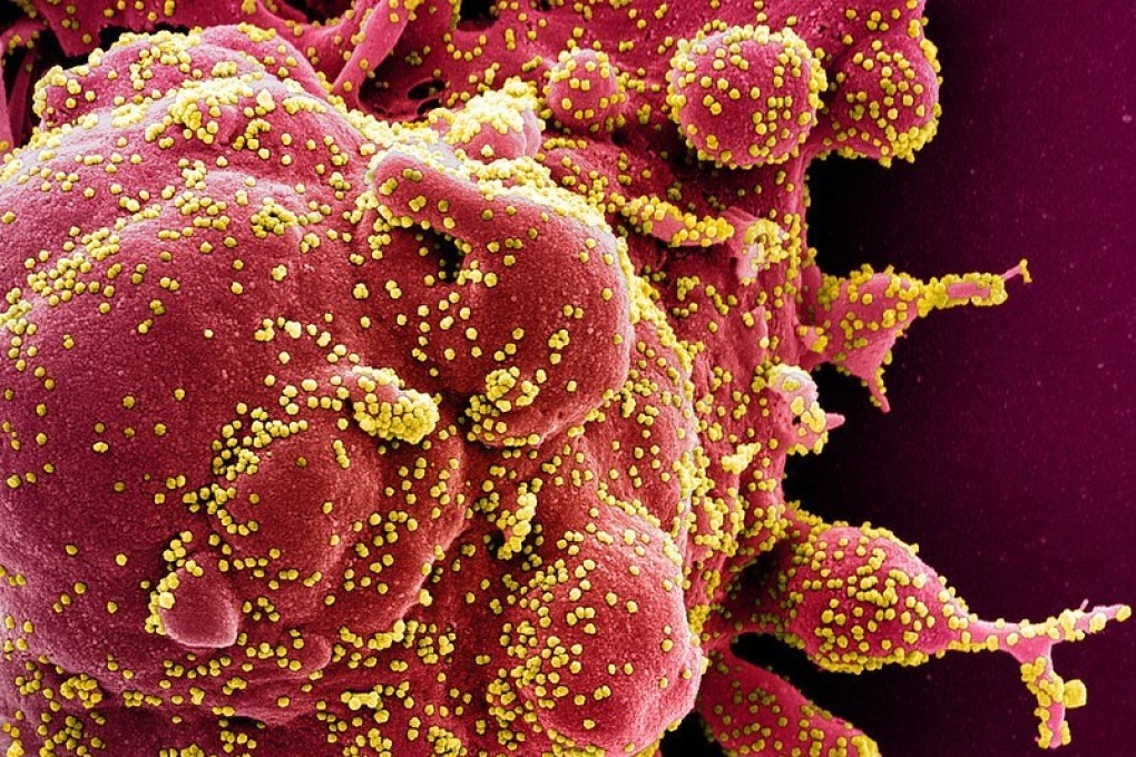 Health experts have suggested genome sequencing could be necessary to track down the origin of a recent Covid-19 case involving the Alpha variant. Photo: AFP