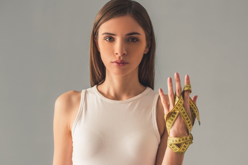 Both skinny- and fat-shaming can smash self-esteem, but discrimination against overweight people is rampant in education, employment and health care. Photo: Shutterstock